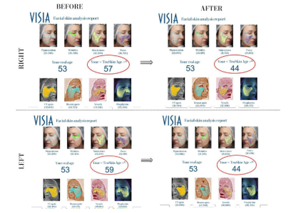 ​​​​​​​Khám phá các nghiên cứu khoa học về hiệu quả của Pluryal Densify trong phục hồi, tái tạo và trẻ hóa da